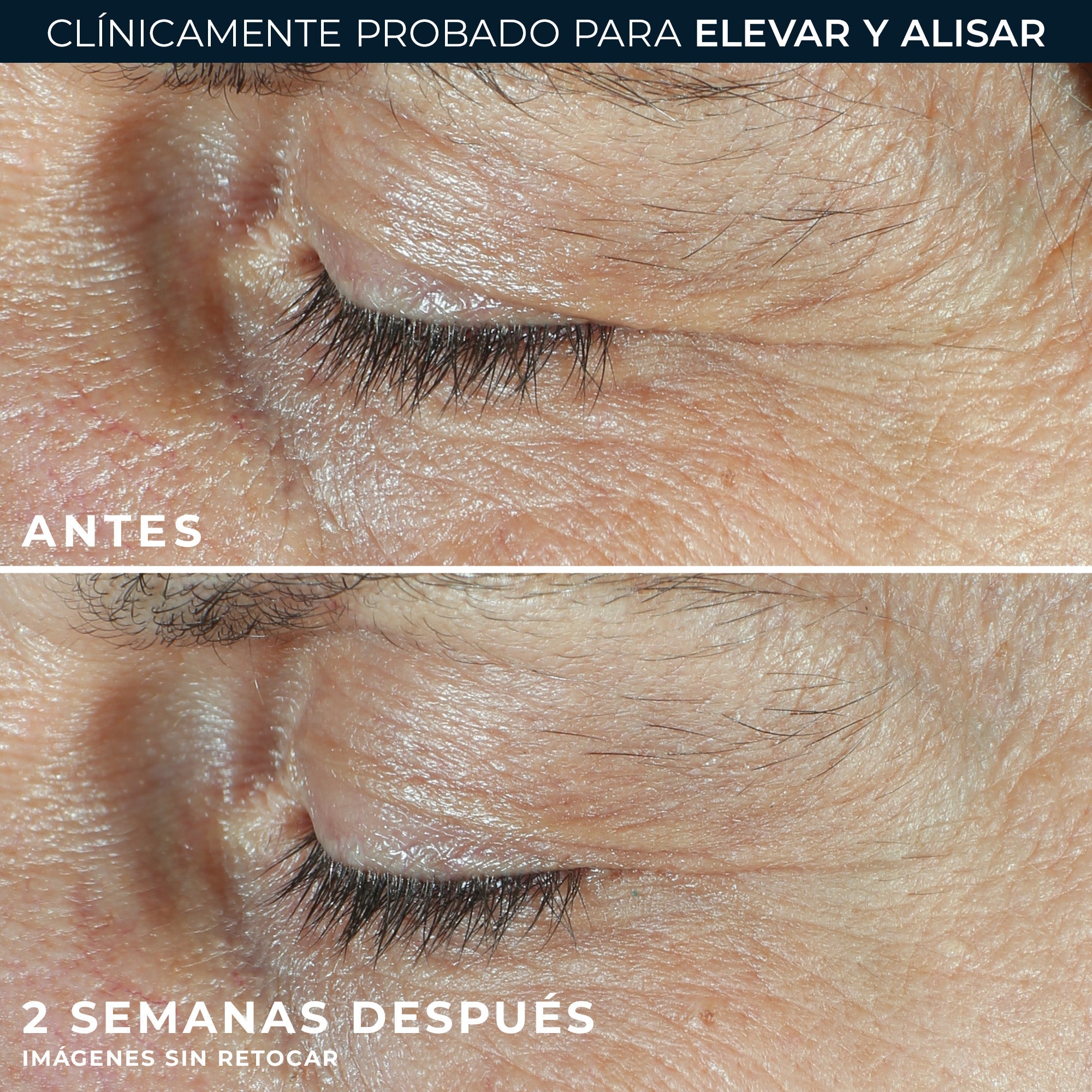 RoC® DERM CORREXION® DUAL EYE 20ML