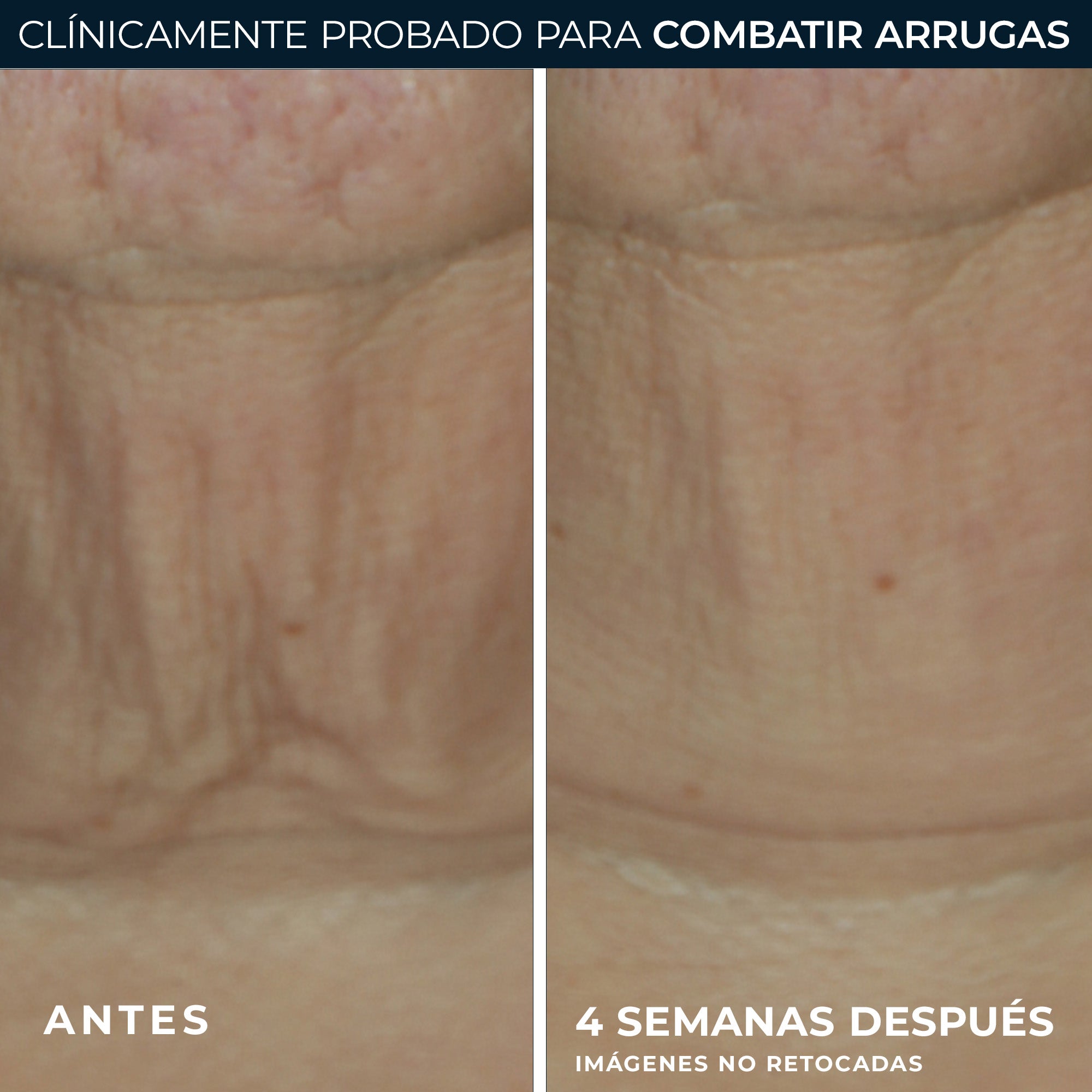 RoC® DERM CORREXION® FIRMING STICK 30G