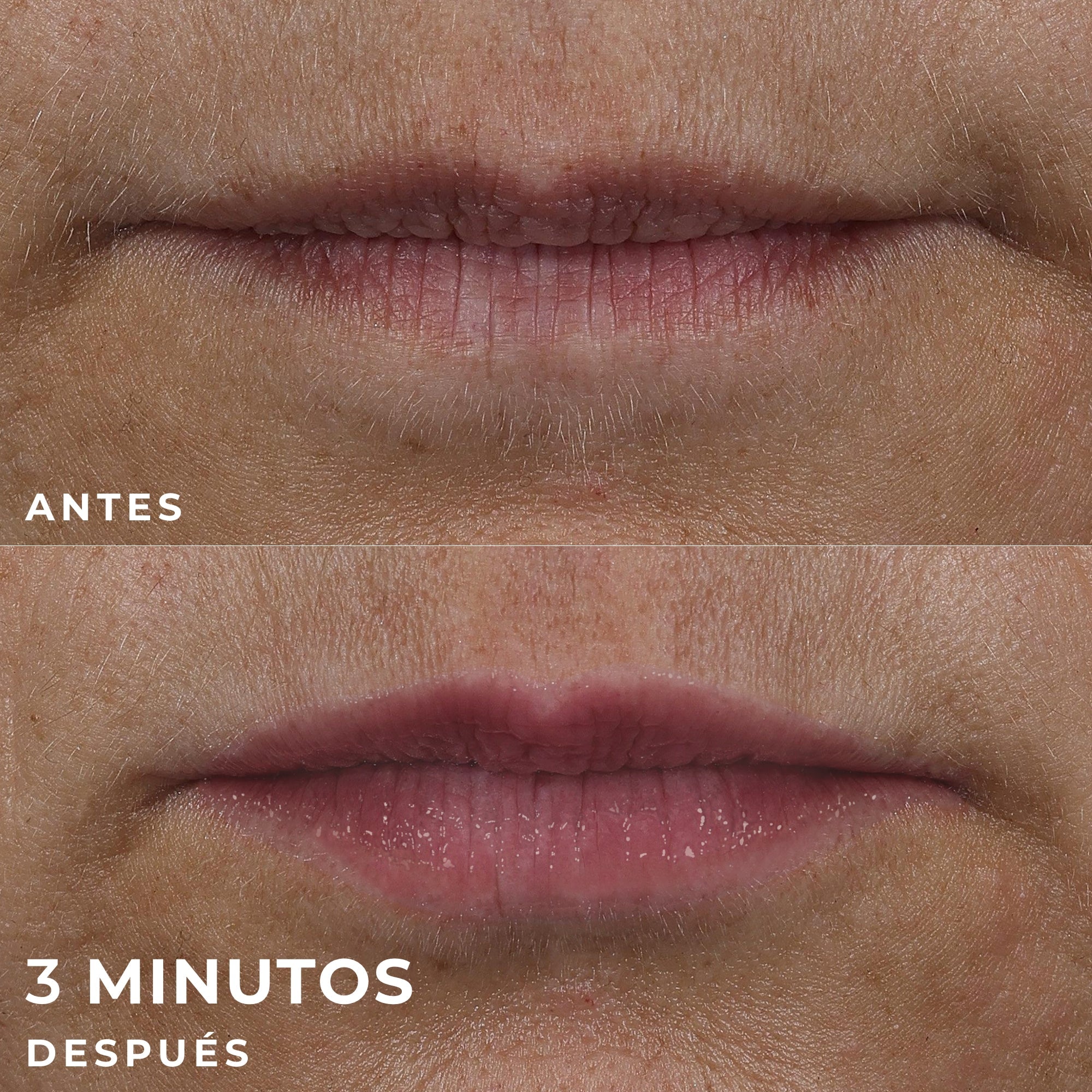 RoC® DERM CORREXION® LIP VOLUMIZER 10ML