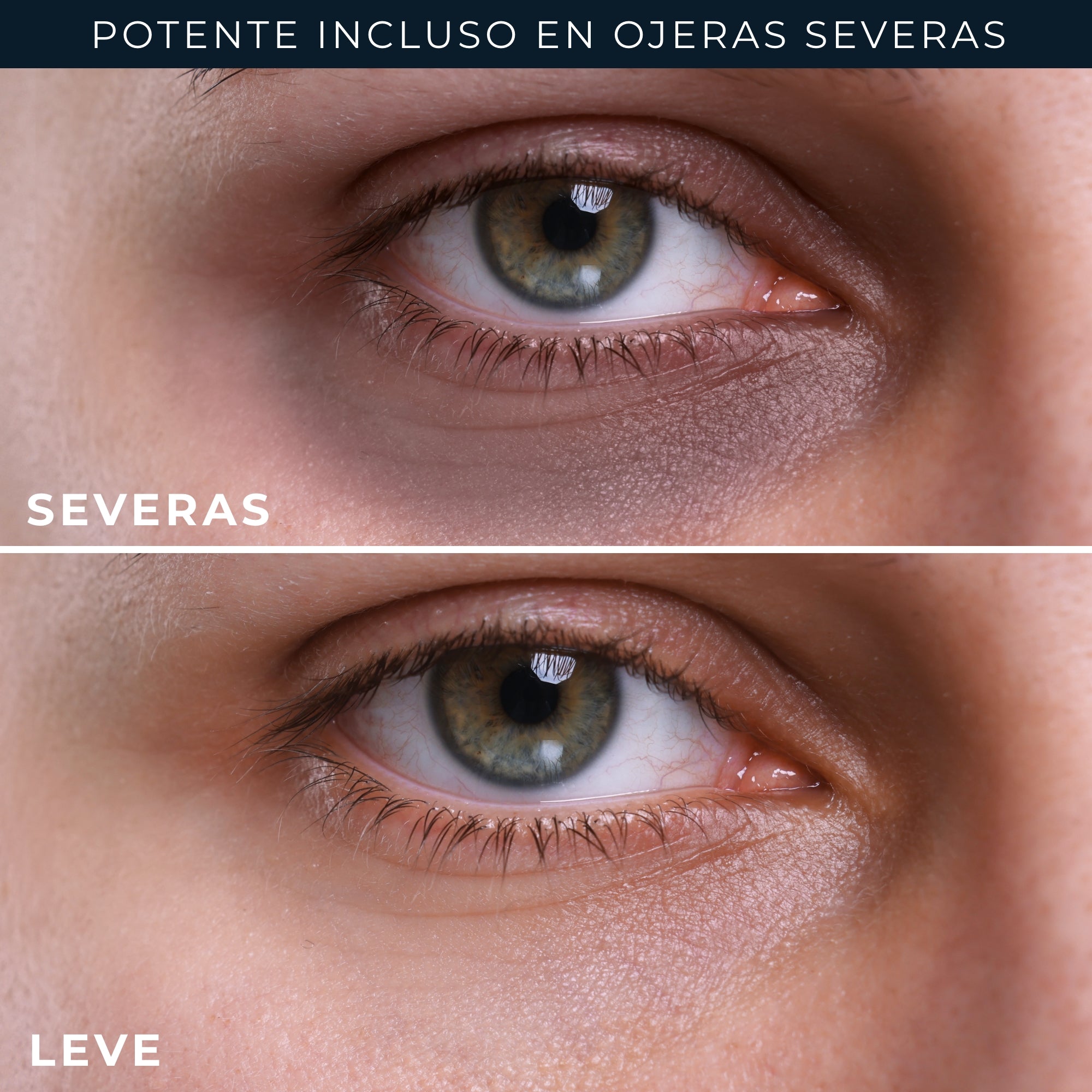RoC® DERM CORREXION® EYE REPAIR 15ML