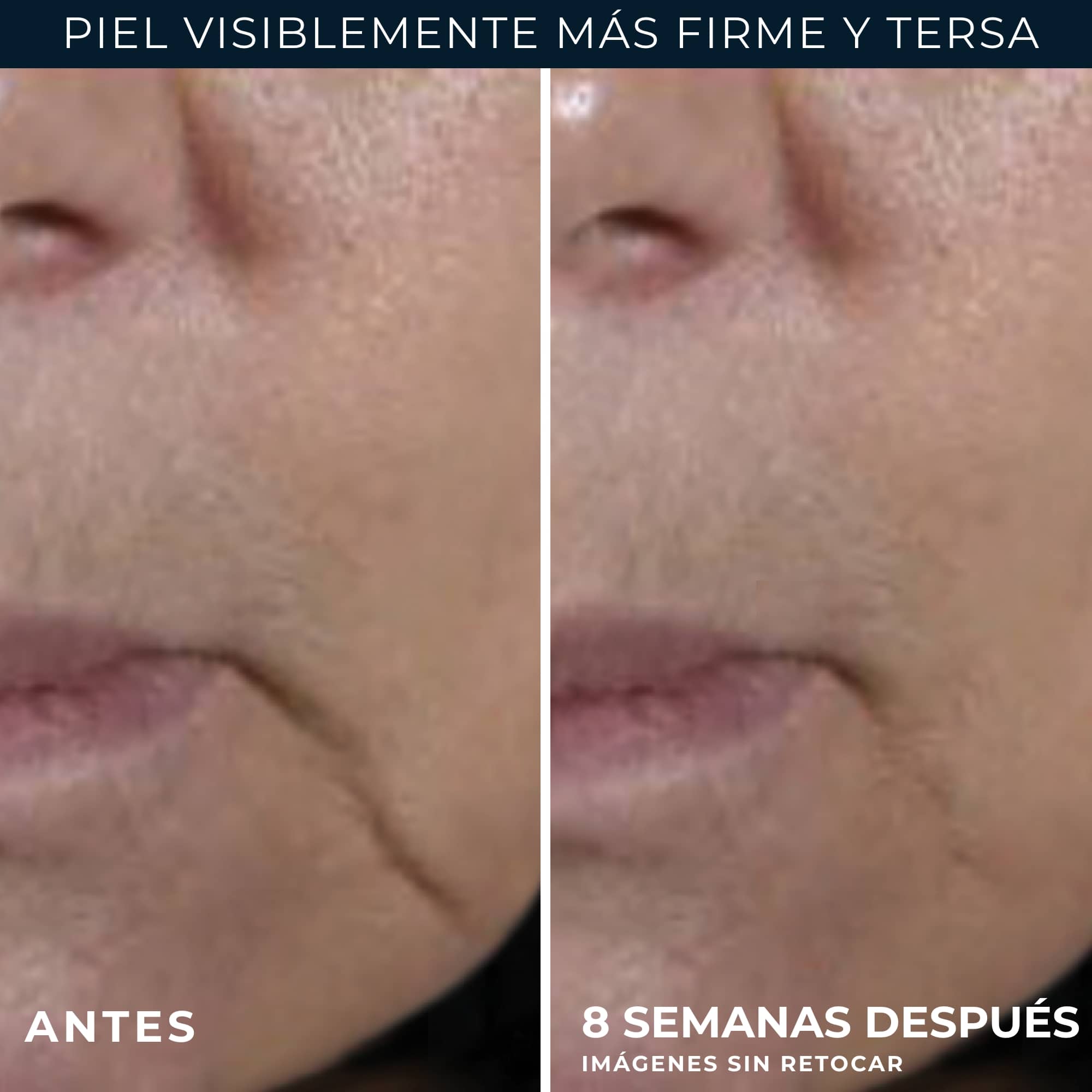 RoC® FIRM + LIFT CREMA REAFIRMANTE 50ML