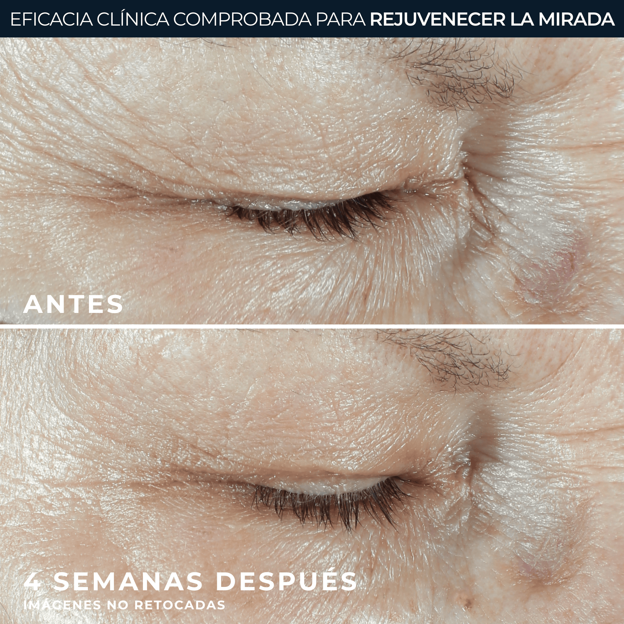 RoC® HYDRATE + PLUMP CONTORNO DE OJOS 15ML