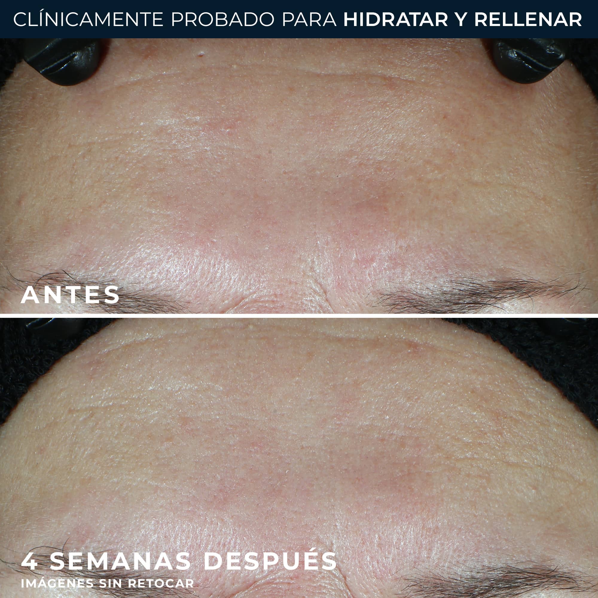 RoC® HYDRATE + PLUMP CREMA HIDRATANTE 50ML