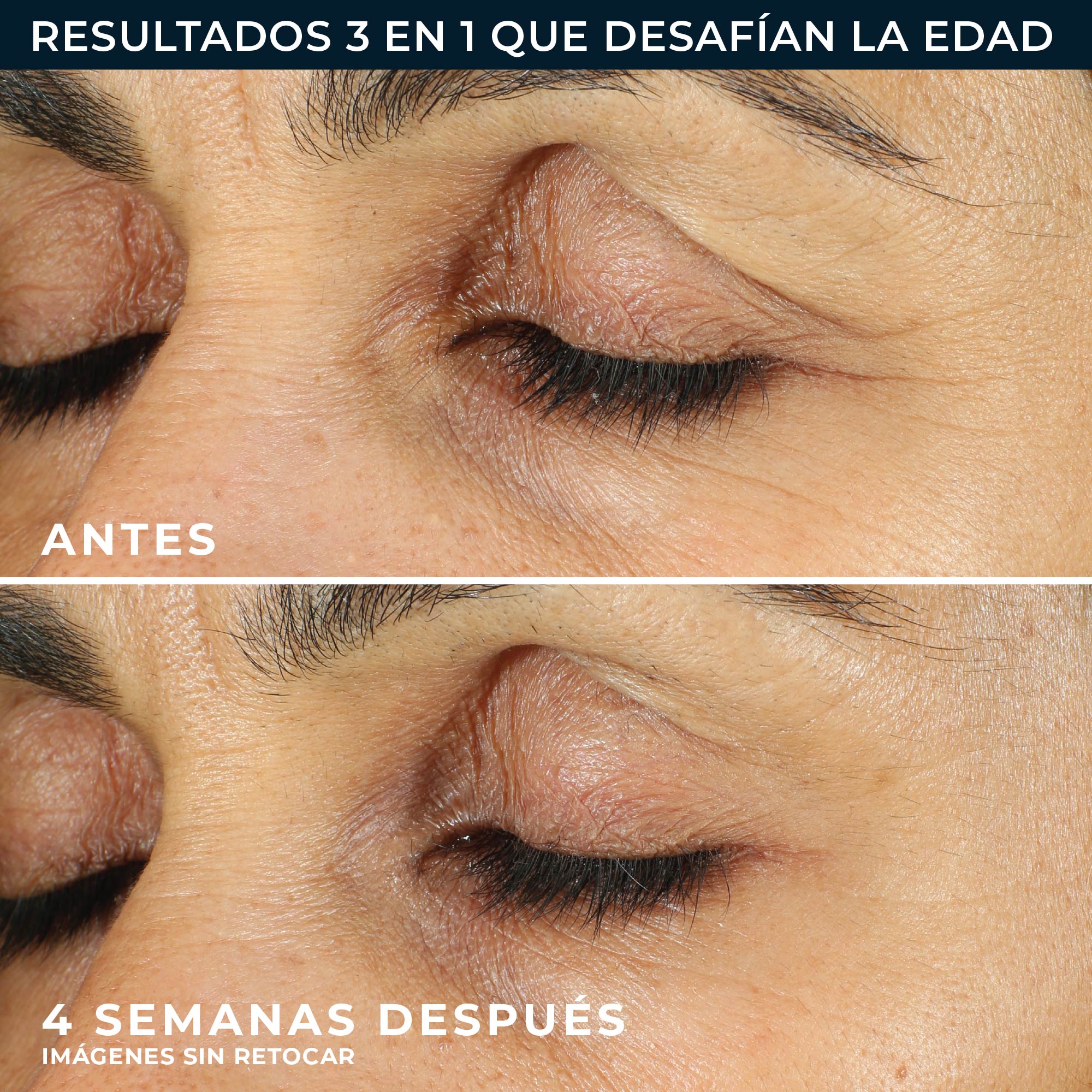 RoC® LINE SMOOTHING CONTORNO DE OJOS 15ML