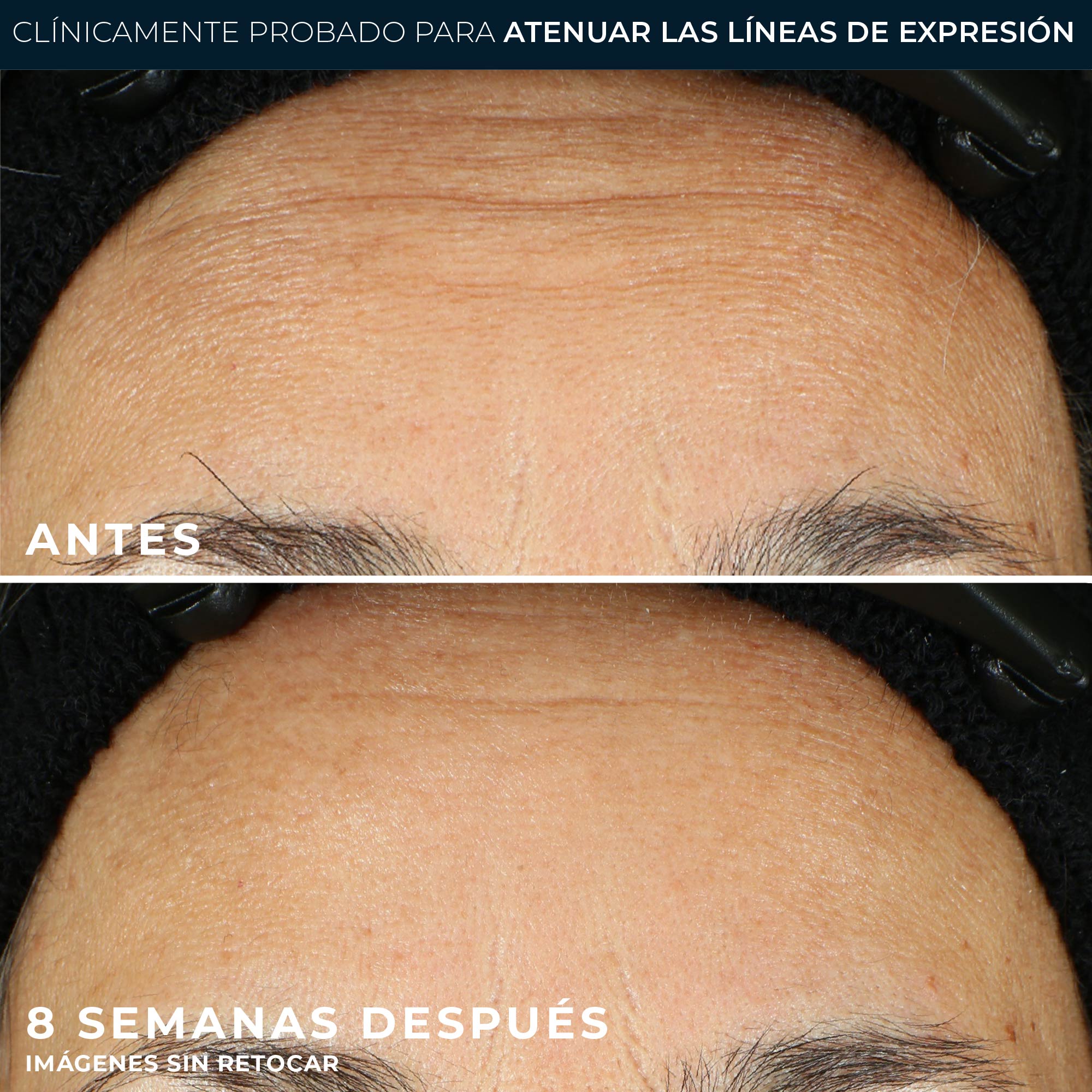 RoC® LINE SMOOTHING SÉRUM EN CÁPSULAS 30uds