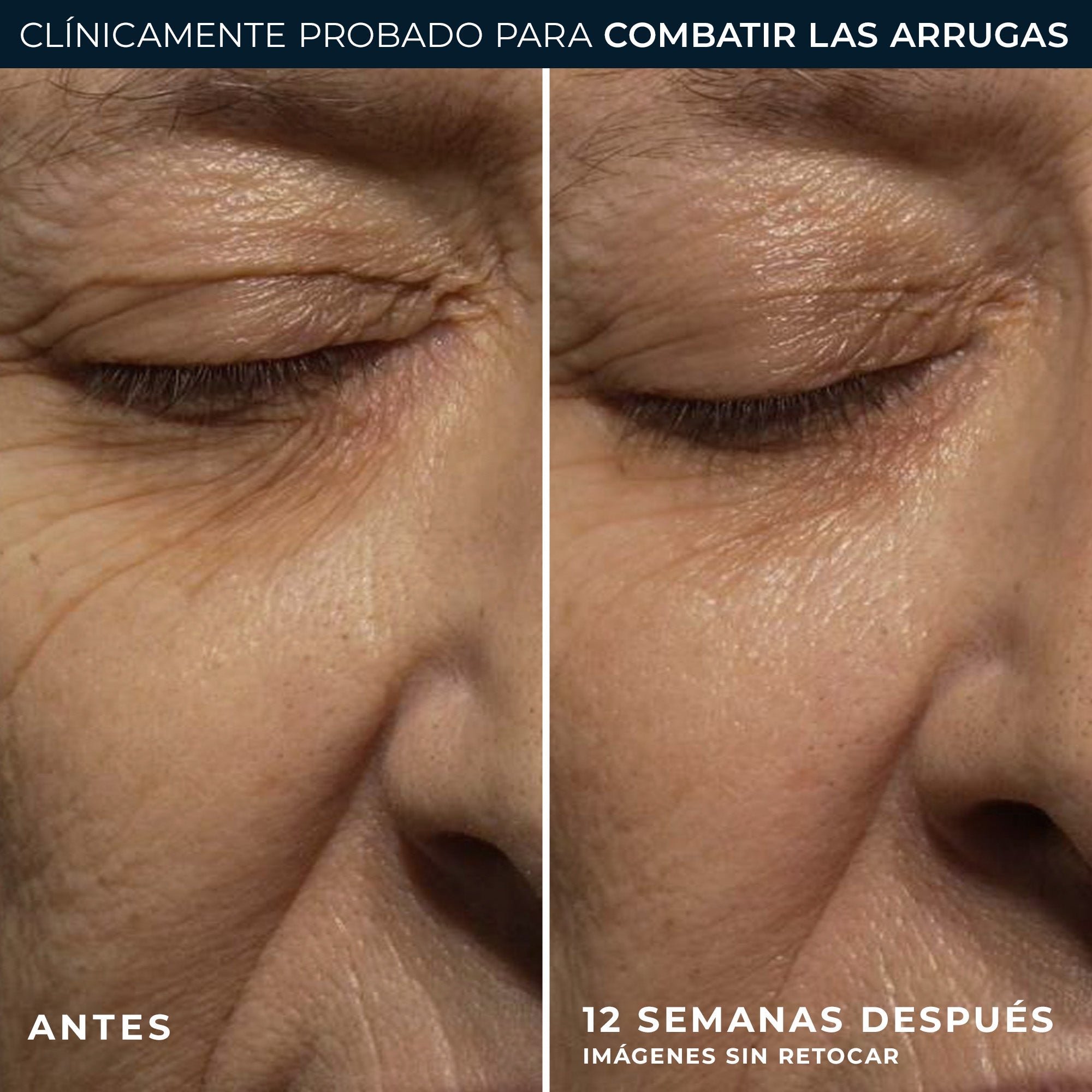 RoC® WRINKLE CORRECT CREMA NOCHE 30ML