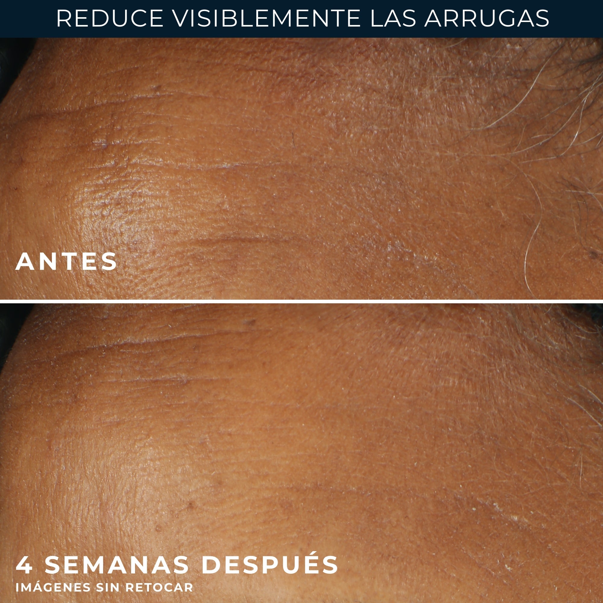 RoC® WRINKLE CORRECT CREMA DÍA SPF30 30ML